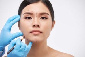 drawing marks for surgery 2021 08 26 19 52 48 utc 1